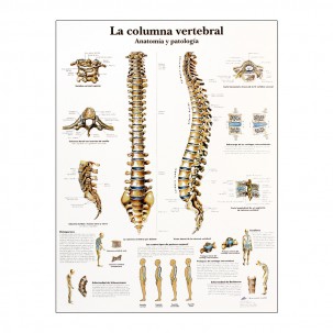 Impression d'anatomie : colonne vertébrale